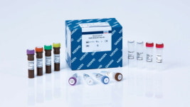 퀴아젠코리아, 요로상피암 동반진단 유전자 검사 시약 ‘테라스크린 FGFR Kit’ 국내 허가