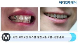치협, 비의료인 ‘투스젬’ 불법 시술 고발…검찰 송치