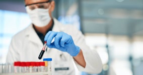 다우바이오메디카, 대장암 치료 ctDNA 기반 MRD 검사로 새 지평 열리나