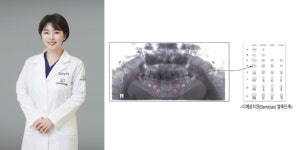 더케이365치과병원 정미리 원장, ‘치과 방사선 영상 기반 치아 발육단계 자동 검출 기술’ 특허등록
