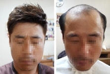 가발 티 안 나고 자연스러운 헤어스타일 연출하는 웨이브스킨