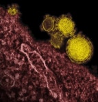 [메르스 공포 확산] 꼭 알아야 할 10가지, 증상·진단 방법은?