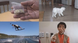 세상에 이런일이 #의문의 치아 #뒤로 걷는 개 #16세 웨이크보더 챔피언 #얼굴 섬유종 남자