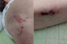 인천 서구 요양병원서 90대 노인 폭행 의혹…병원 측은 부인