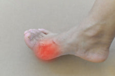 퓨린적은 소주, 통풍 위험 적다? 다사랑병원 잘못된 정보