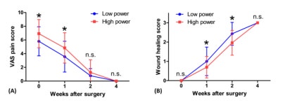아주대병원 박도양 교수팀 편도절제술 시 전기세기 낮추면 통중도 줄인다