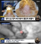 길고양이 뱃속에 케이블 타이 발견…TNR 사업 맺은 동물병원 의심