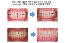 우린 예뻐지려고 치과 간다!