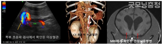 [전문의가 전하는 펫의 세계]반려동물도 CT·MRI를 찍어요?