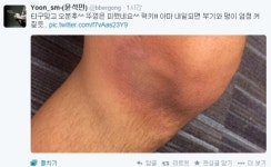 윤석민 2승 눈앞에 두고 무릎부상 교체