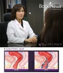 부부 모두 만족할 수 있는 질성형은 질필러성형