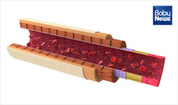 ‘담적’이 오래되면 ‘담석증’ 되나요?