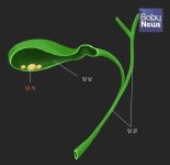 통증과 소화장애가 담석증 증상으로 나타나는 이유?