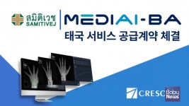 크레스콤, 태국 사미티벳 병원에 AI 골연령 분석 솔루션 MediAI-BA 수출 계약 체결