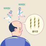콜라겐 섭취가 탈모 치료에 도움이 될까?