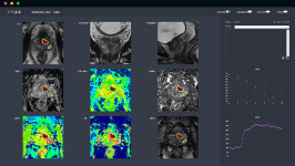 [특징주] 제이엘케이, 전날 상한가 이어 13% 급등...1만8천원선 돌파