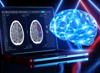 [특징주] 제이엘케이, 의료 AI 시장에 AI 솔루션 메디허브 스트로크 주목