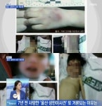 대중 경악케 한 성민이 사건 대체 뭐길래?...보육교사로부터 심한 괴롭힘 당해...먹은 음식물 토하는 데도 제대로 돌봐주지 않고 온몸엔 피멍자국... 
