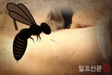 [추적] ‘봉침시술 쇼크사’ 양·한방 갈등으로 번진 까닭