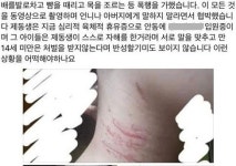 평소 맘에 안든다 안동서 여중생 집단 폭행···경찰 조사 중