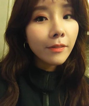 신봉선, 코성형 재수술로 업그레이드된 미모 눈길 