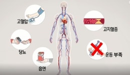 생로병사의 비밀 소리없이 진행되다 갑자기 위험 드러내는 동맥의 경고