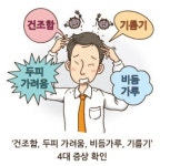 비듬 제대로 없애는 4가지 키 포인트