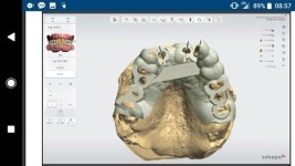 일산 리빙웰 치과병원 김현철 병원장, 일본 구루메 대학 초청 강의