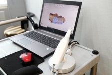 치과 치료와 디지털 기술의 만남, 덴탈스캐너 3D 캐드캠 시스템
