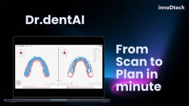 이노디테크, AI 덴탈 솔루션으로 글로벌 시장 공략