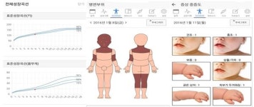 강동경희대한방병원, 아토피모바일수첩 개발