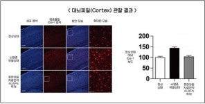 한약, 기억력 개선 및 뇌 염증 억제 효과 입증됐다