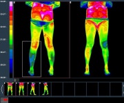 [기고]허리디스크 환자의 적외선체열진단기기 이용