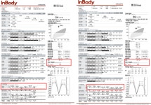 [기고] 난치성 만성피로 증후군 염증 치료하기_면역력 회복력 검사 만성피로 판단 지표들 (4)