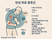 만성 염증 환자 치료케이스-대사증후군 만성염증 환자의 증상(1)-전신 피로감과 두통생기능의학