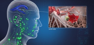 브이티바이오, 면역세포 활용 알츠하이머병 치료제 개발 가속