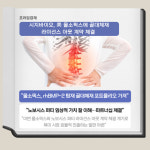 [카드] 시지바이오, 올소픽스에 골대체재 노보시스 퍼티 공급