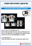 [카드] 제이엘케이, 레메디에 JVIEWER-X 납품 계약 체결