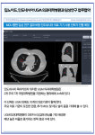 [카드] 딥노이드, 인도네시아 UGM 의과대학병원과 임상연구 업무협약