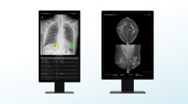 루닛, GC녹십자아이메드에 AI 암 진단 솔루션 공급…건강검진 시장 사업 확장