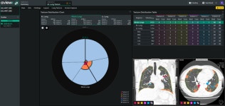 코어라인소프트, MS 이어 38조 매출 빅파마 베링거에 솔루션 본격 공급