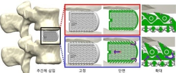 [케이메디허브 소식] 2025 MEDITEK 참가해 우수기술 선보여