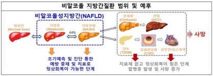 비알코올성지방간 방치 시 심혈관질환 최대 8배 증가
