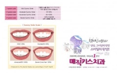 매직키스치과의 아름다운 미소를 위한 거미스마일 분류와 치료법