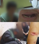 궁금한 이야기Y 폭력적인 무속인의 정체, 생니 뽑기·돌 나르기 충격