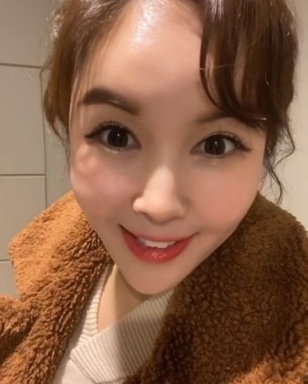 장영란 해명…'눈 성형'에 관심 집중 '나에게 맞는 수술방법은?'
