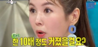 장영란, 눈 콤플렉스로 성형? 