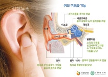 갑자기 소리가 안 들려요 난청 치료 서둘러야
