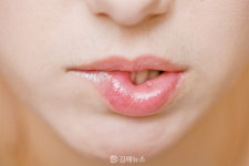 입 안의 고통, 구내염 … 원인·예방법은?