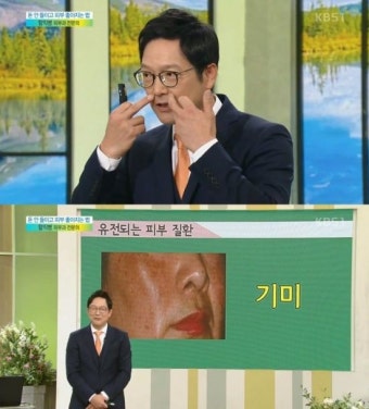 함익병 